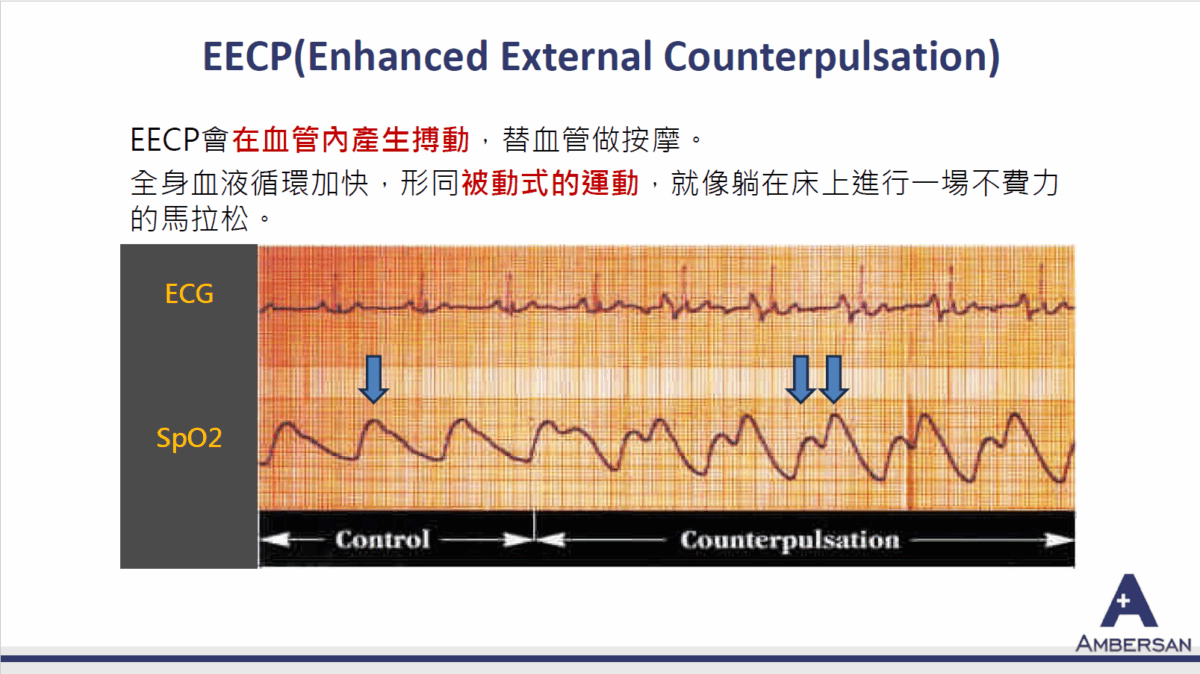 安博生EECP介紹3
